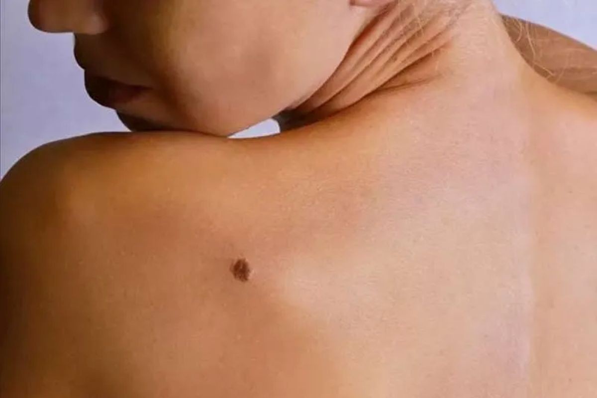 neo schiena pelle donna